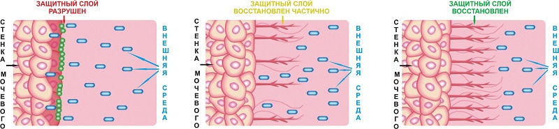 защитный слой мочевого пузыря