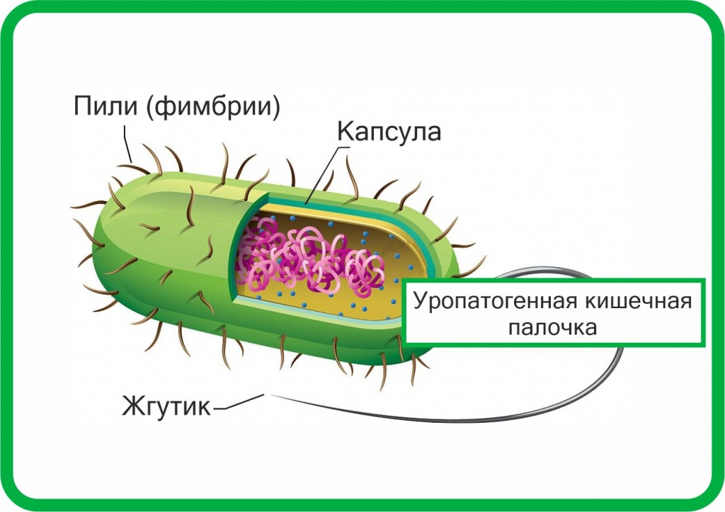 острый цистит бактерия.jpg