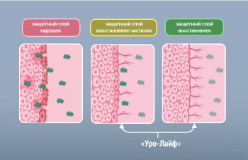 УРОЛАЙФ PRO