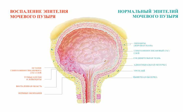 мочевой пузырь.png